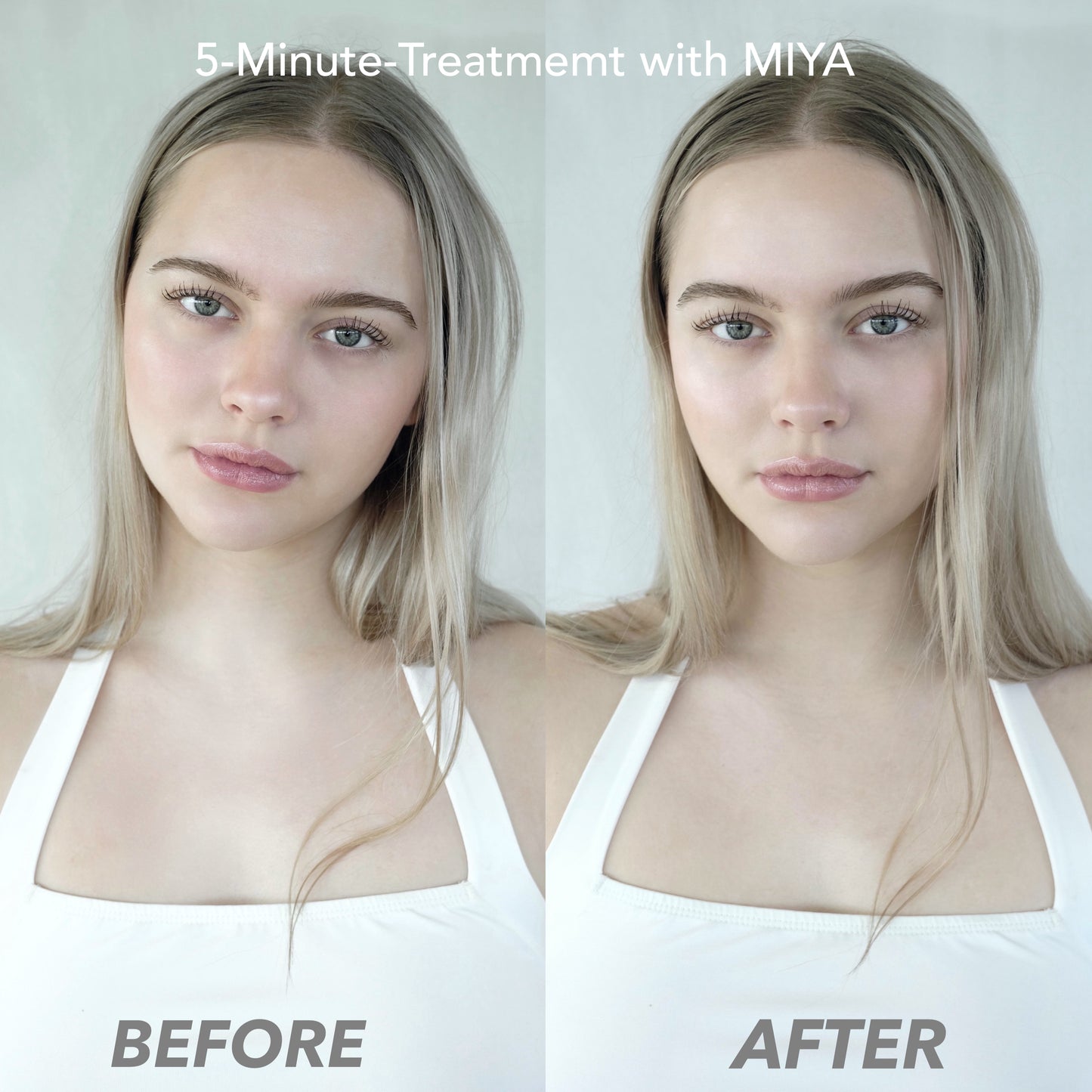 b.elle MIYA Mikrostrom Facelift-Gerät