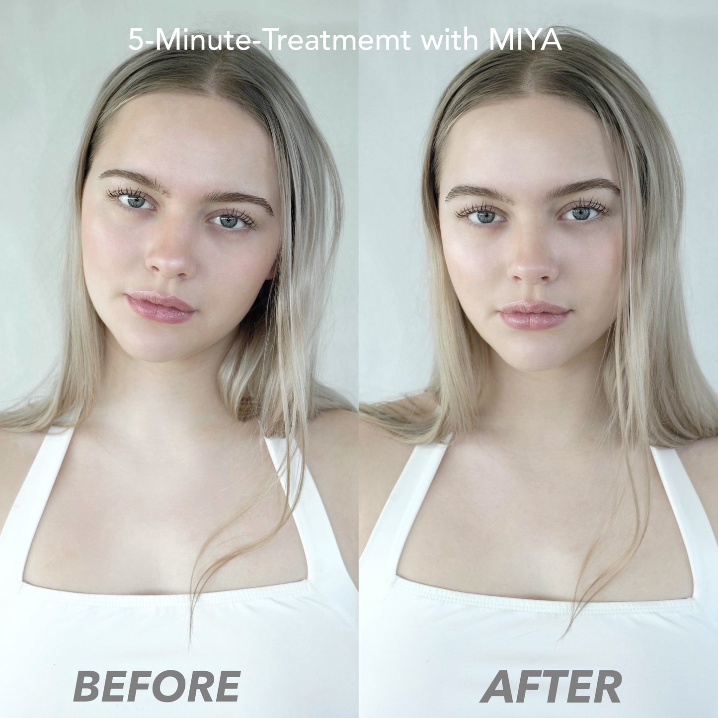 MIYA Microcurrent Facial Toning Device